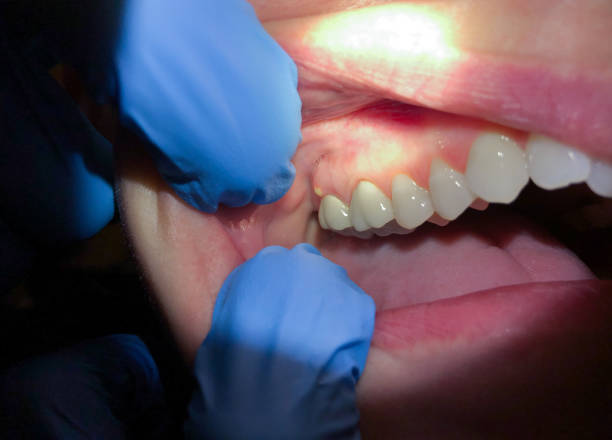 Best Pediatric Emergency Dentist in Havelock, NC
