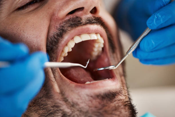 Best Emergency Gum Treatment in Havelock, NC