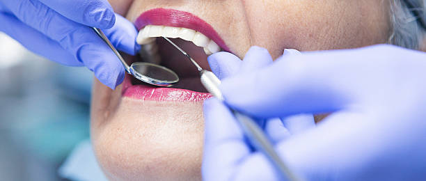 Best Emergency Tooth Extraction in Havelock, NC